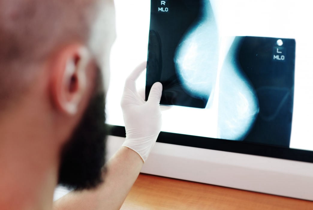 Médico conferindo exame de ultrassom das mamas
